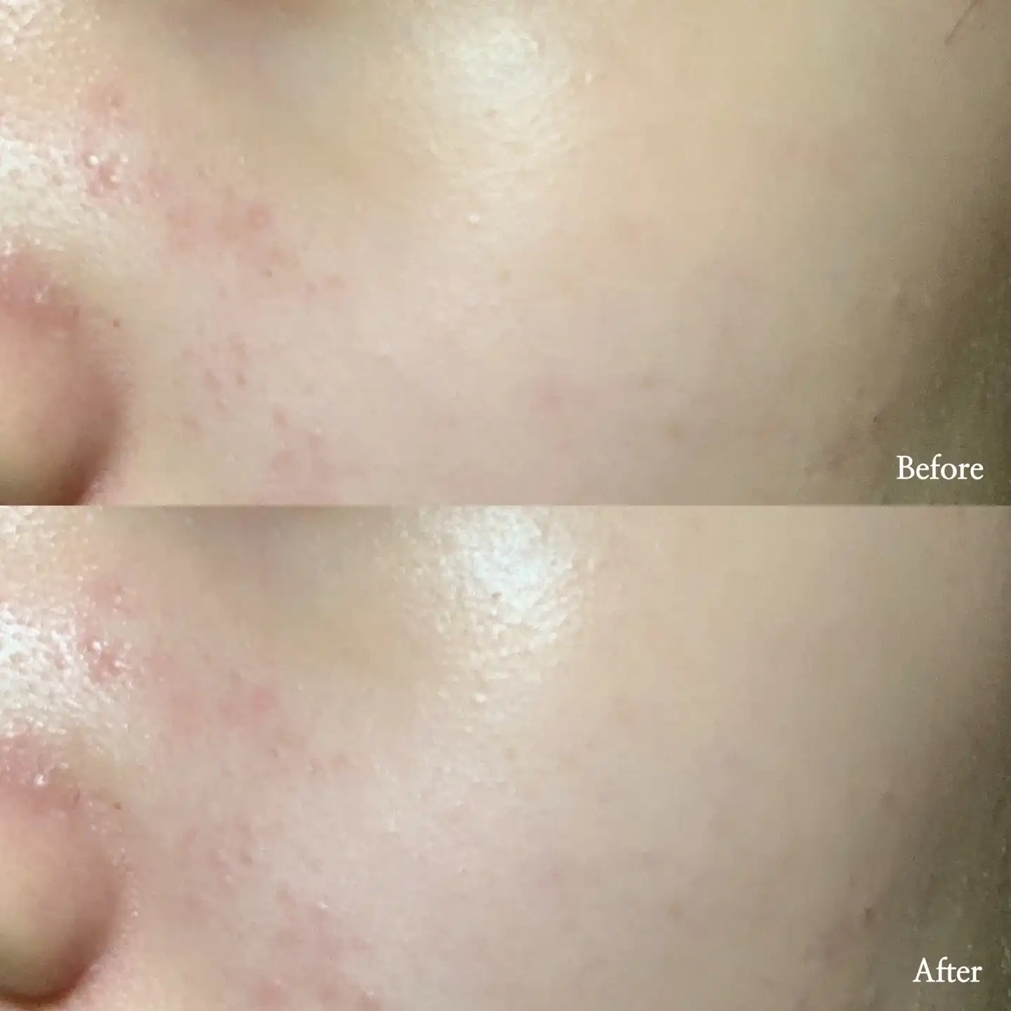 아텔로콜라겐500 파워풀럼핑 크림