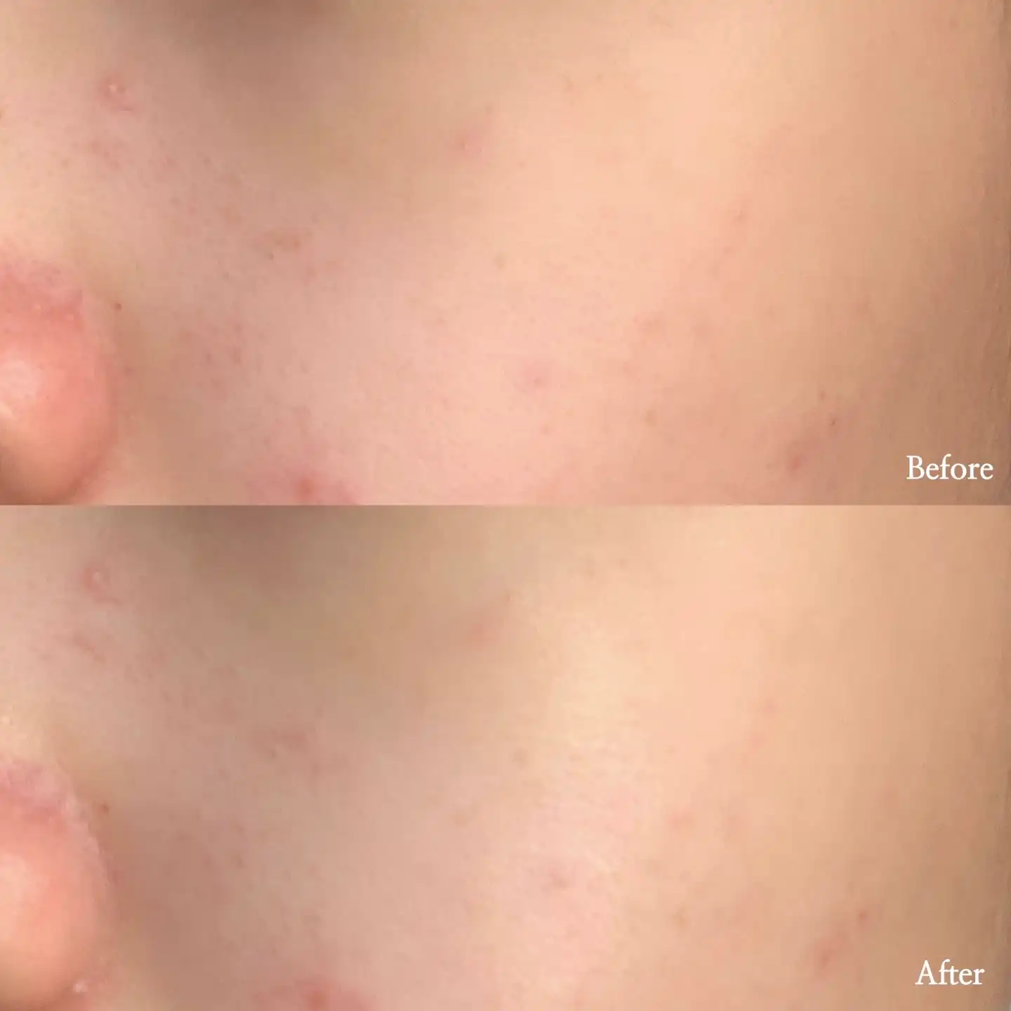 바이탈 포메그레닛 인텐시브 시카앰플