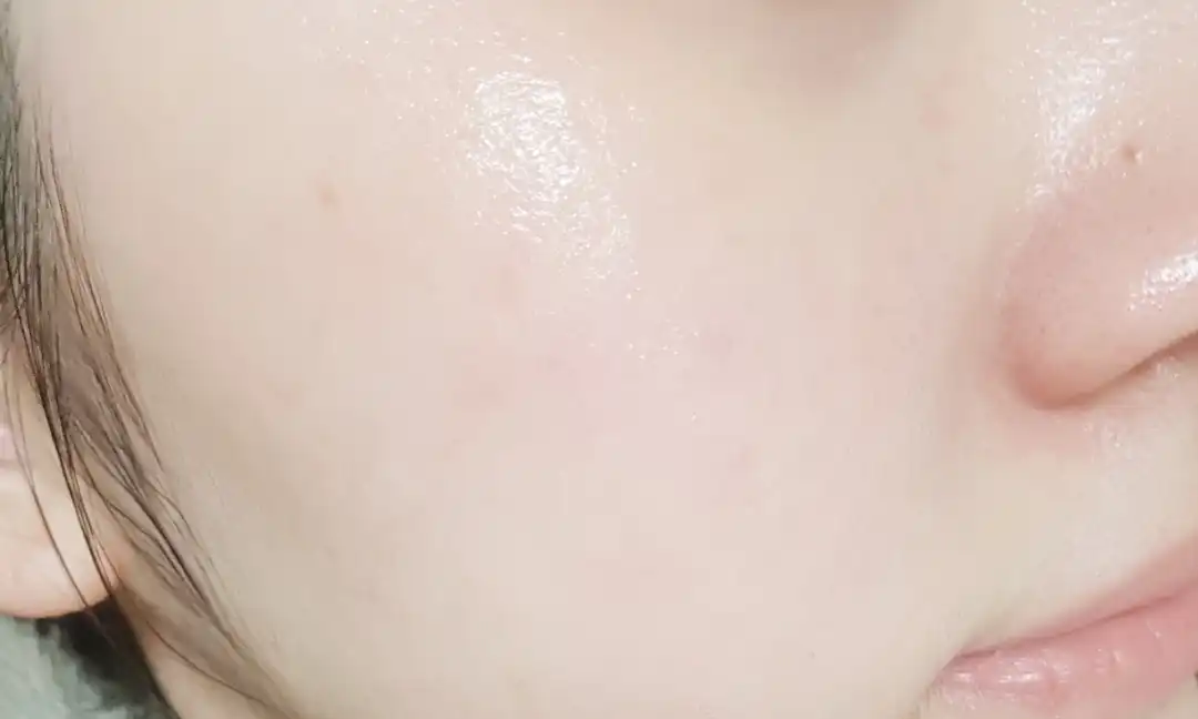 비폴렌 리뉴 앰풀러