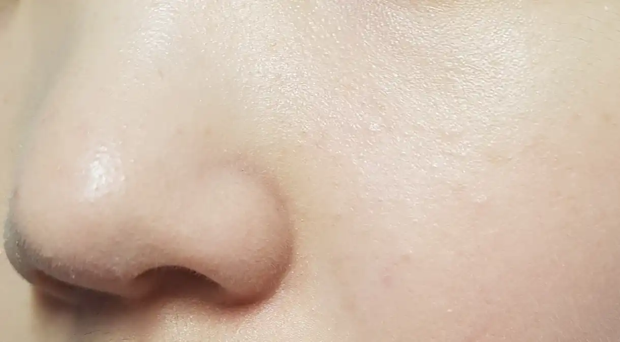 오렌지스킨딜리트 (모공딜리트)