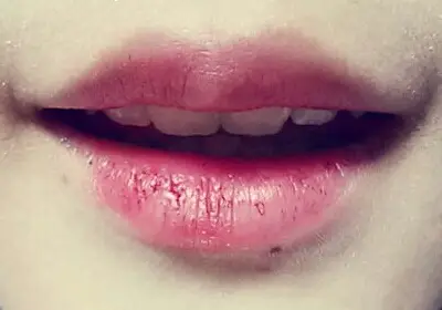 선택된 언니의파우치 리뷰 이미지 - [디어 마이 블루밍 립스-톡 (겁먹은 레드)]