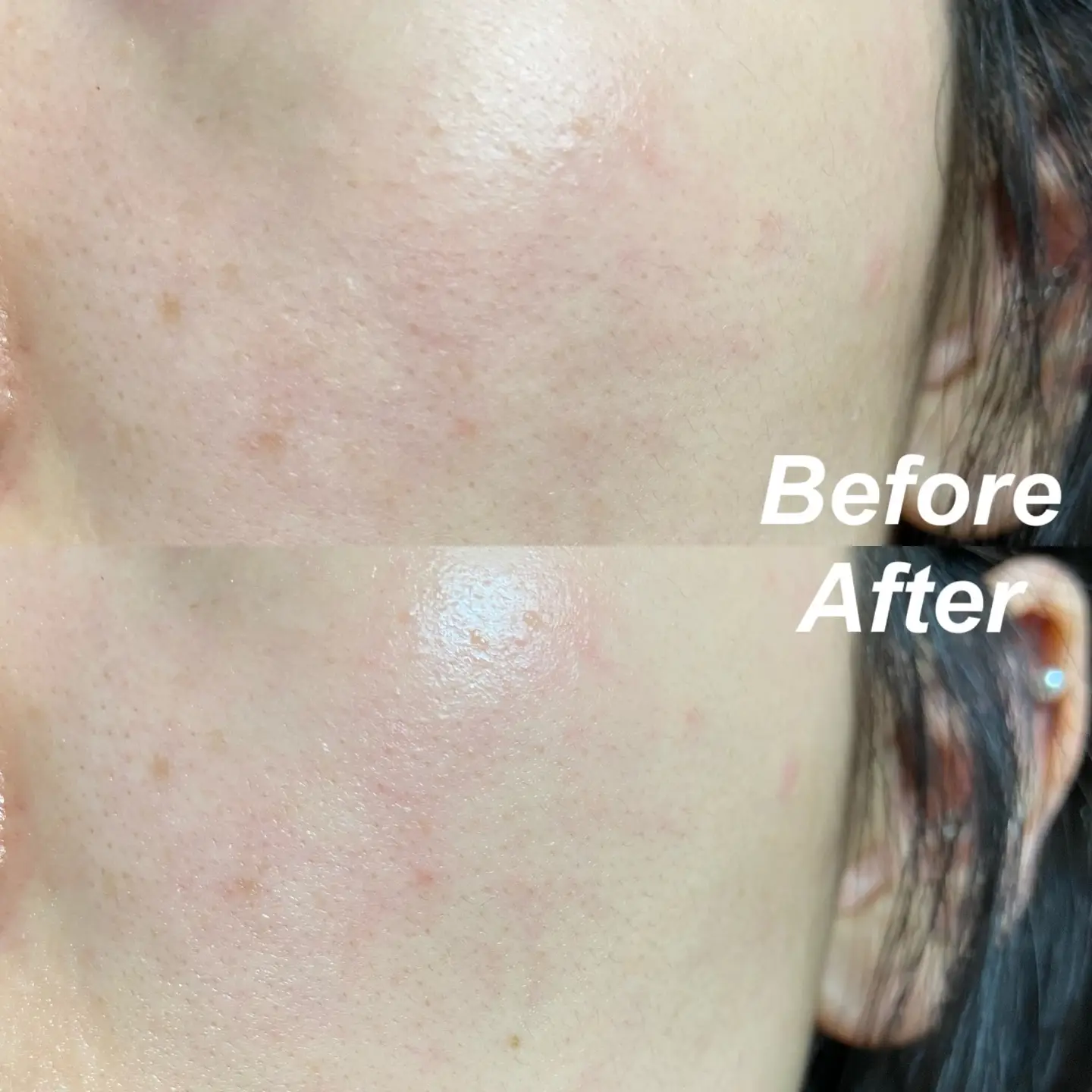 선택된 언니의파우치 리뷰 이미지 - [맑음빛 레드빈 브라이트닝 앰플]