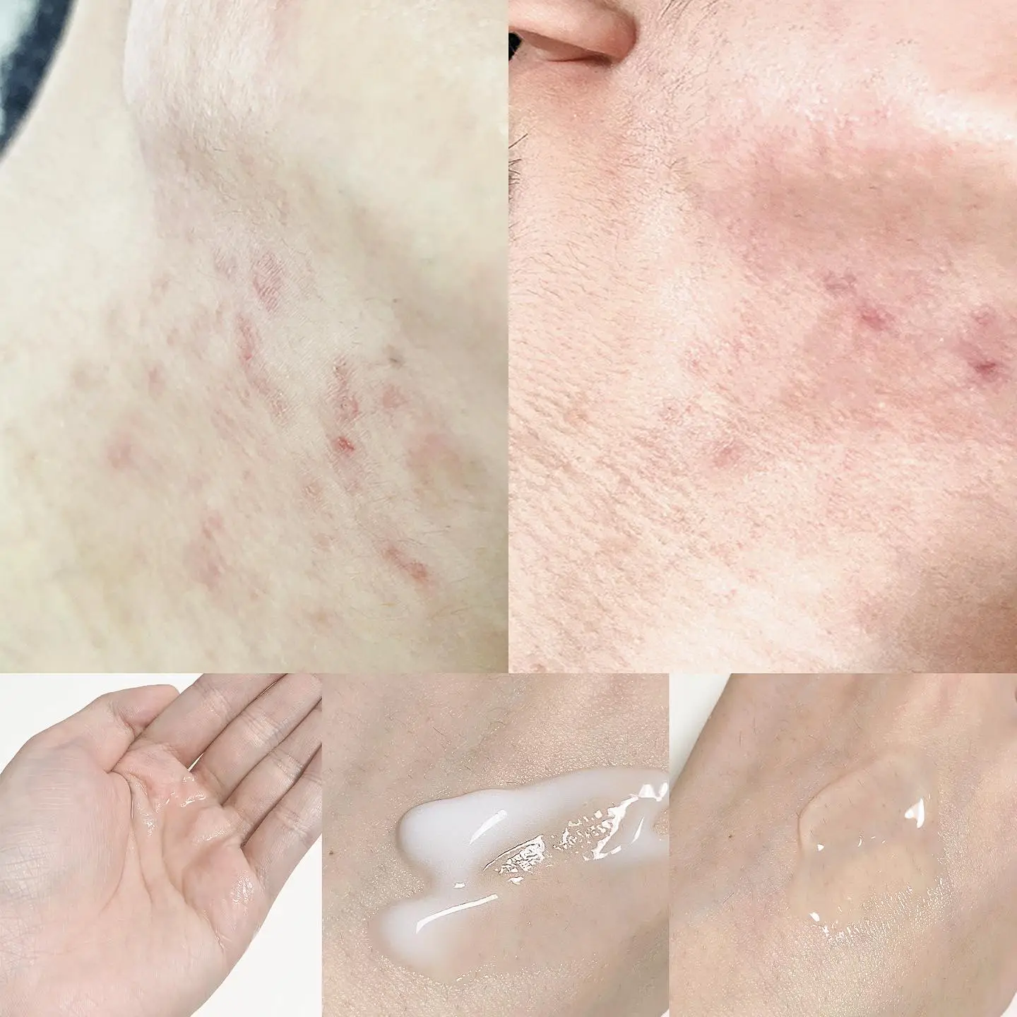 선택된 언니의파우치 리뷰 이미지 - [그린더마 티트리시카 수딩크림]