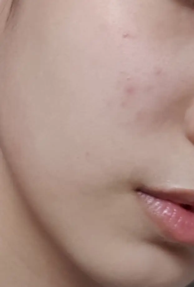 선택된 언니의파우치 리뷰 이미지 - [닥터락토 배리어 크림]