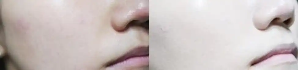 언니의파우치 리뷰 이미지 7 - [푸로루나 샤이니 에센스 CC쿠션 [23호 내추럴베이지]]