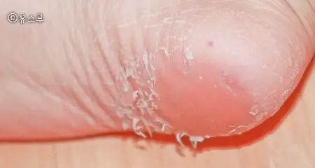 선택된 언니의파우치 리뷰 이미지 - [스마일 풋 필링 마스크]